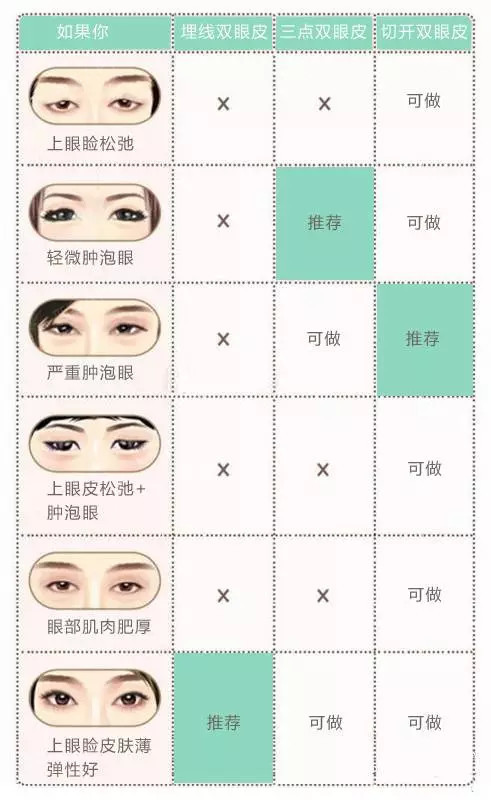 如何養(yǎng)出雙眼皮——全方位指南，全方位指南，如何養(yǎng)出雙眼皮